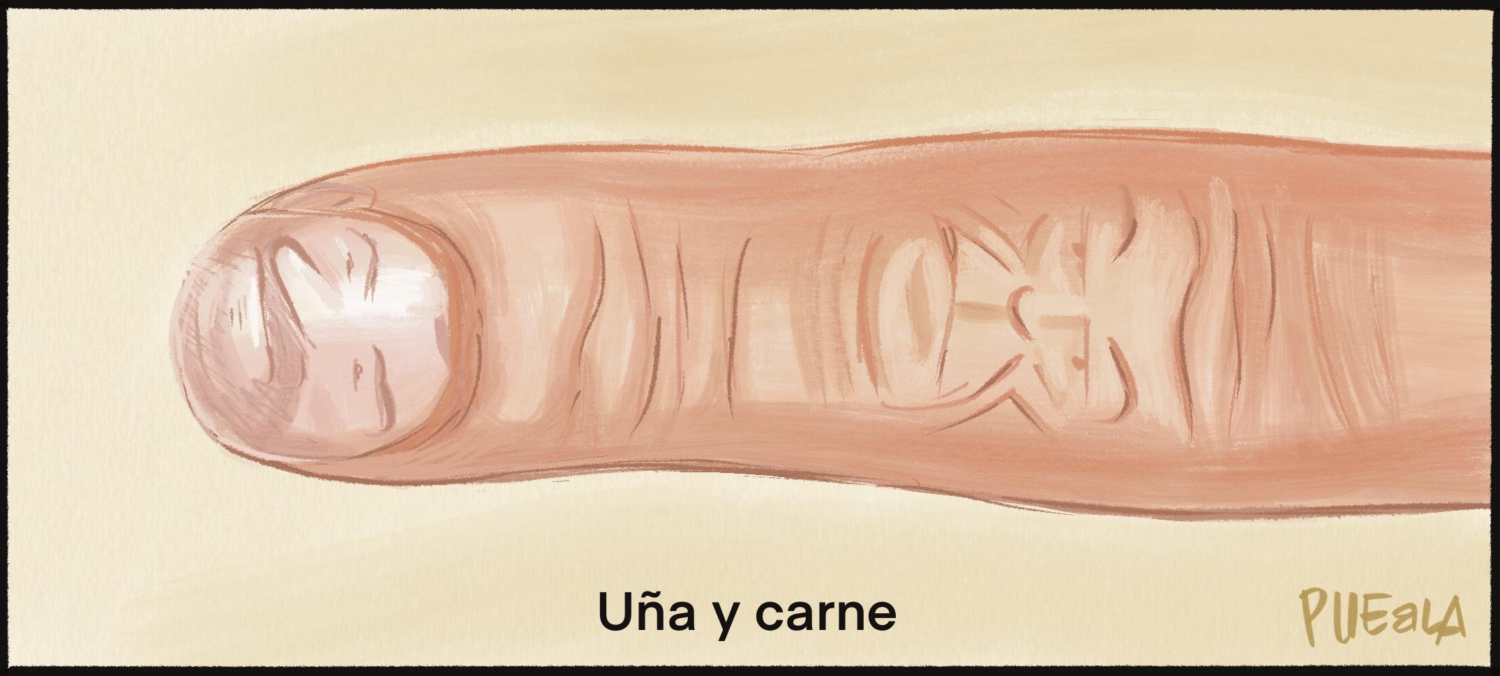 Íntimos. Caso koldo.